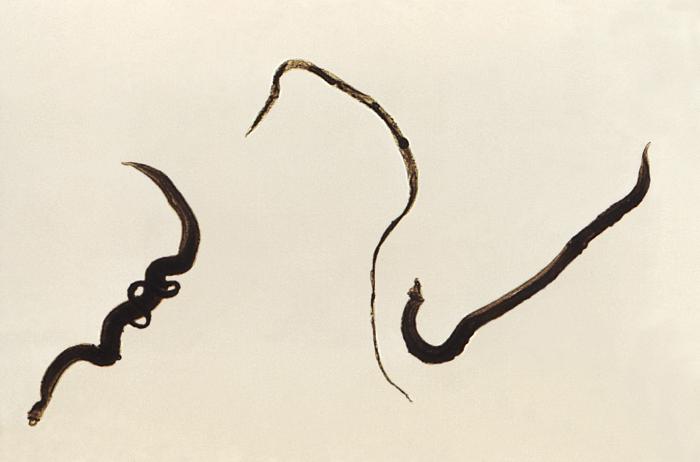 Salvensis Schistosomiasis